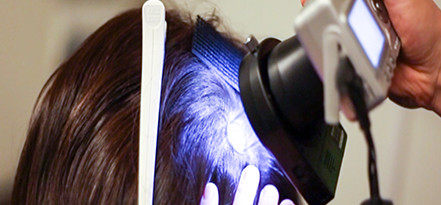 育毛効果の検証イメージ