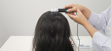 頭皮環境改善試験イメージ
